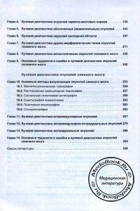 Сторінка 2 змісту книги про променевої діагностики пухлин головного і спинного мозку