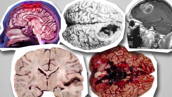 причини інфікування