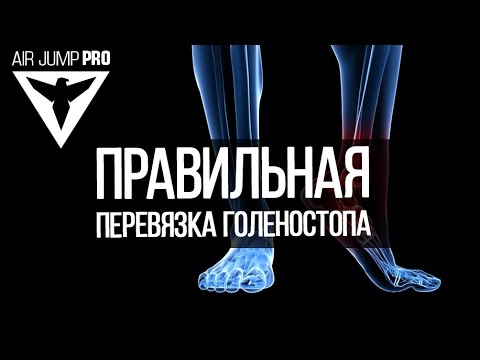 Розтягування голеностопа ноги |  Накладення правильної пов'язки