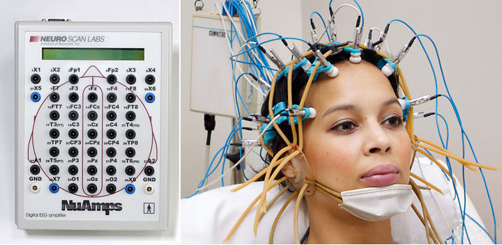 ЕЛЕКТРИЧНА АЛЬФА-АКТИВНІСТЬ ГОЛОВНОГО МОЗКУ   [Electrical alpha-activity of the brain]   (Лат