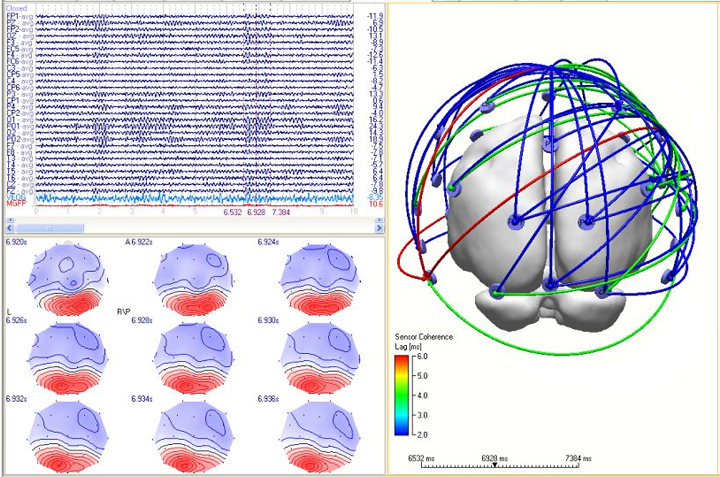 Модифікація: Neuroscan