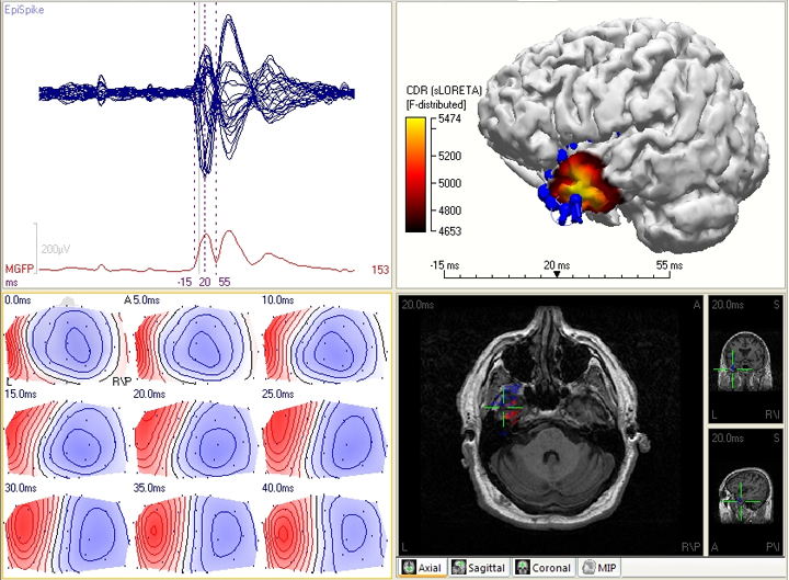 Модифікація: Neuroscan