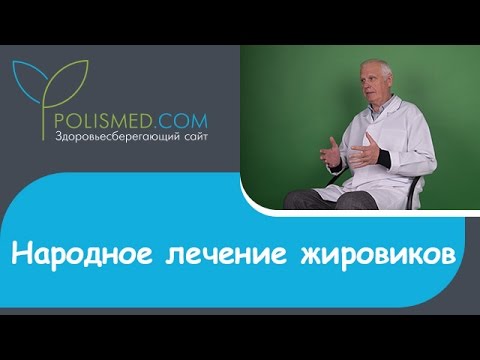Народне лікування ліпоми: цибулею, йодом, буряком, часником, перекисом водню, чистотілом, корицею