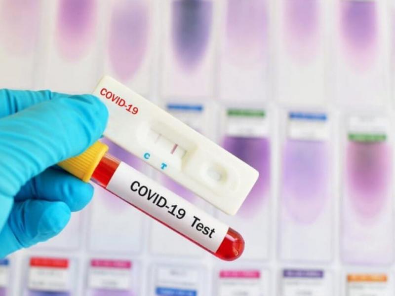 Экспресс тестирование на коронавирус