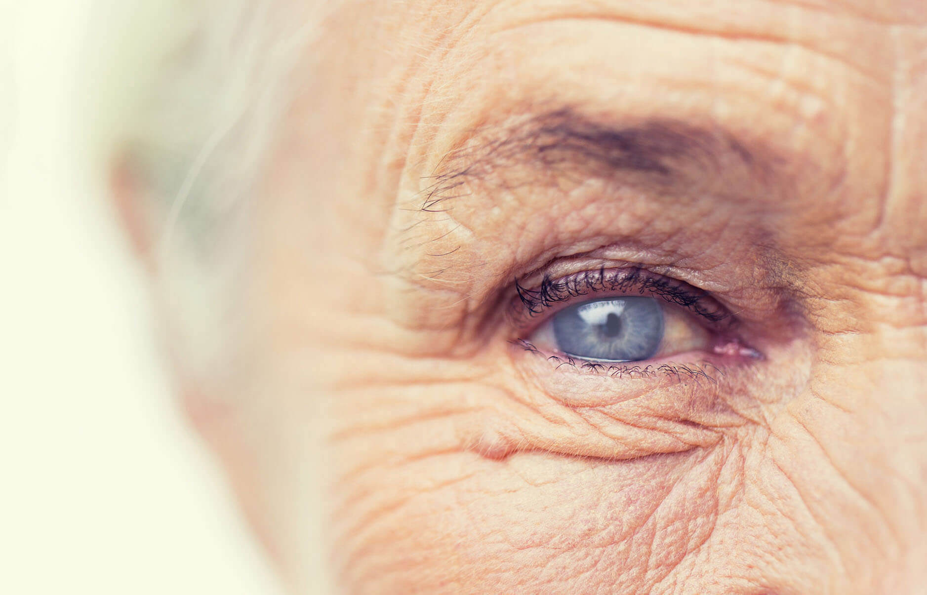 Катаракта, также известная как катаракта у пожилых людей, является одним из распространенных заболеваний этого возраста