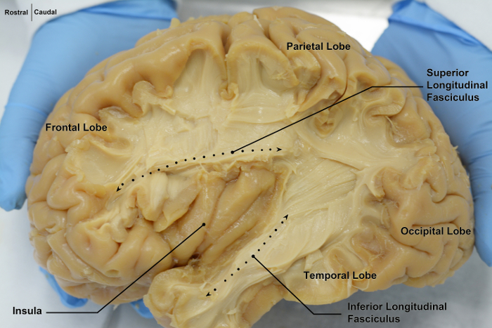Малюнок 3: Вид з лівого боку мозку