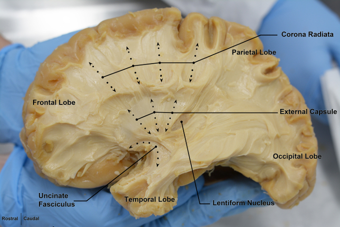 Малюнок 4: Вид з лівого боку мозку