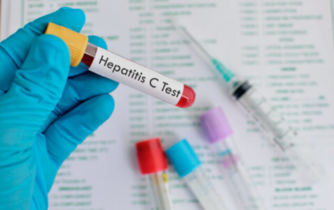 Гепатит: профілактика захворювання