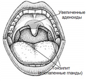 Без спеціального обладнання (ендоскопа) це зробити неможливо