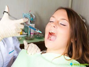 У стоматології має місце ще одна досить складна операція, що викликає хворобливі симптоми - це видалення зуба мудрості