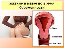 Прояв печіння в області   матки   під час   вагітності   залежить від особливостей організму конкретної жінки