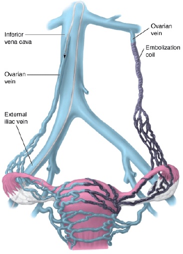 Синуси твердої мозкової оболонки;   Відня губчастого шару кістки;   Відня матки