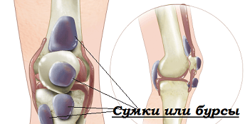 запалення сумки