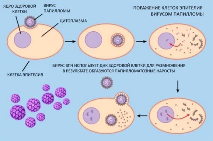 Тому, при наявності хворого людини в сім'ї, необхідно постійно обробляти всі поверхні спеціальним антисептичним засобом, дотримуватися суворих правил щодо особистих контактів і стежити за станом шкірних покривів (навіть мікротріщини можуть стати первісної областю поразки)