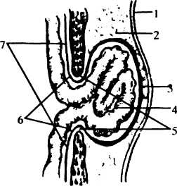 Черевними грижами (hernia abdominalis) називаються патологічні стани, що характеризуються виходженням вмісту черевної порожнини за її межі через природні або штучні отвори черевної стінки при збереженні цілісності парієтальної очеревини і шкірних покривів