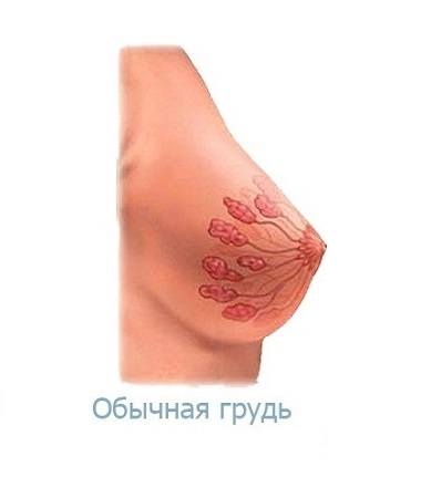 Поки часточки ростуть, сполучні тканини і шкіра розтягуються, в зв'язку з цим починаються болі