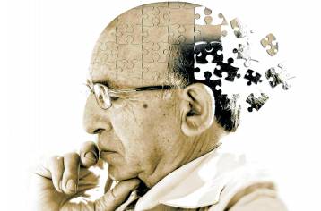 Хвороба Альцгеймера - вікове захворювання, симптоми якого характеризуються поступовим згасанням розумових здібностей, а саме: втратою пам'яті, зміною мови, відсутністю логічного мислення