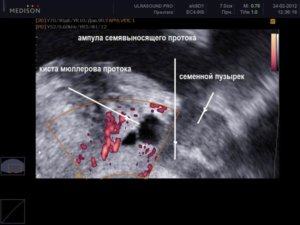 Поява нових діагностичних можливостей в наш час призвело до детального вивчення патофізіологічних механізмів, що лежать в основі даного симптому