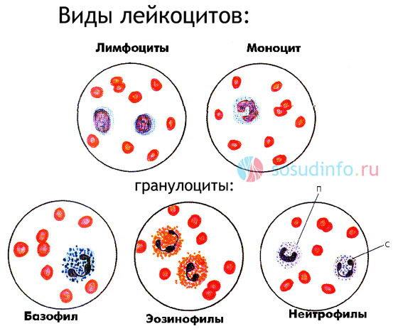 Самі ж нейтрофіли, коли гинуть, звільняють лізосомні ферменти, які розм'якшують тканини і формують гнійний вогнище (абсцес), тому гній являє собою зруйновані нейтрофіли і їх обривки