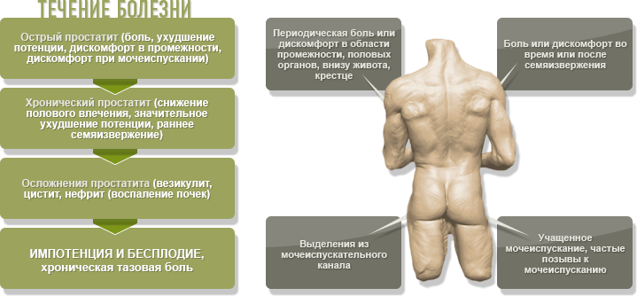 Але якщо людина відчула один з перерахованих нижче ознак, до уролога варто звернутися відразу, не запускаючи хвороба