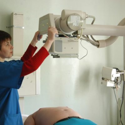 Рентген нирок призначається за особливими показниками лікаря
