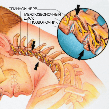 Шийний відділ хребта